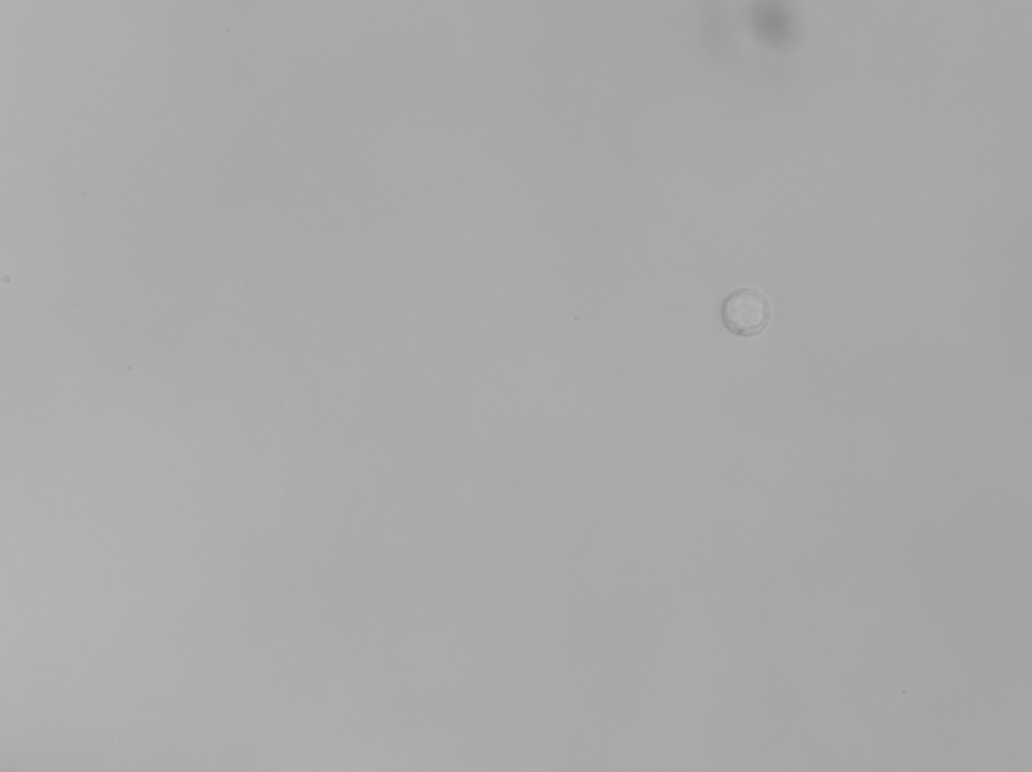 Cerebrospinal fluid imaged by Remoscope