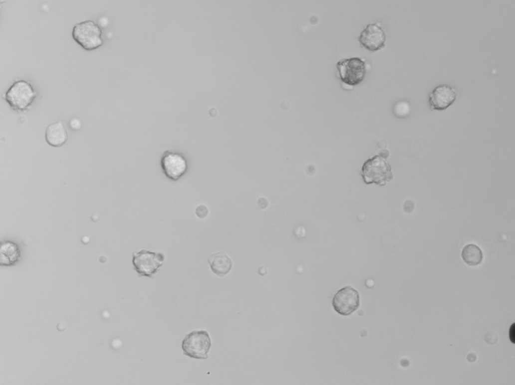 White blood cells imaged by Remoscope