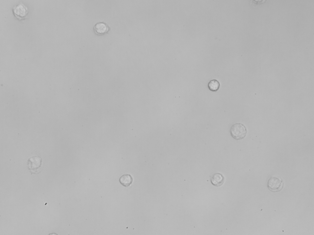 Lymphocytes imaged by Remoscope